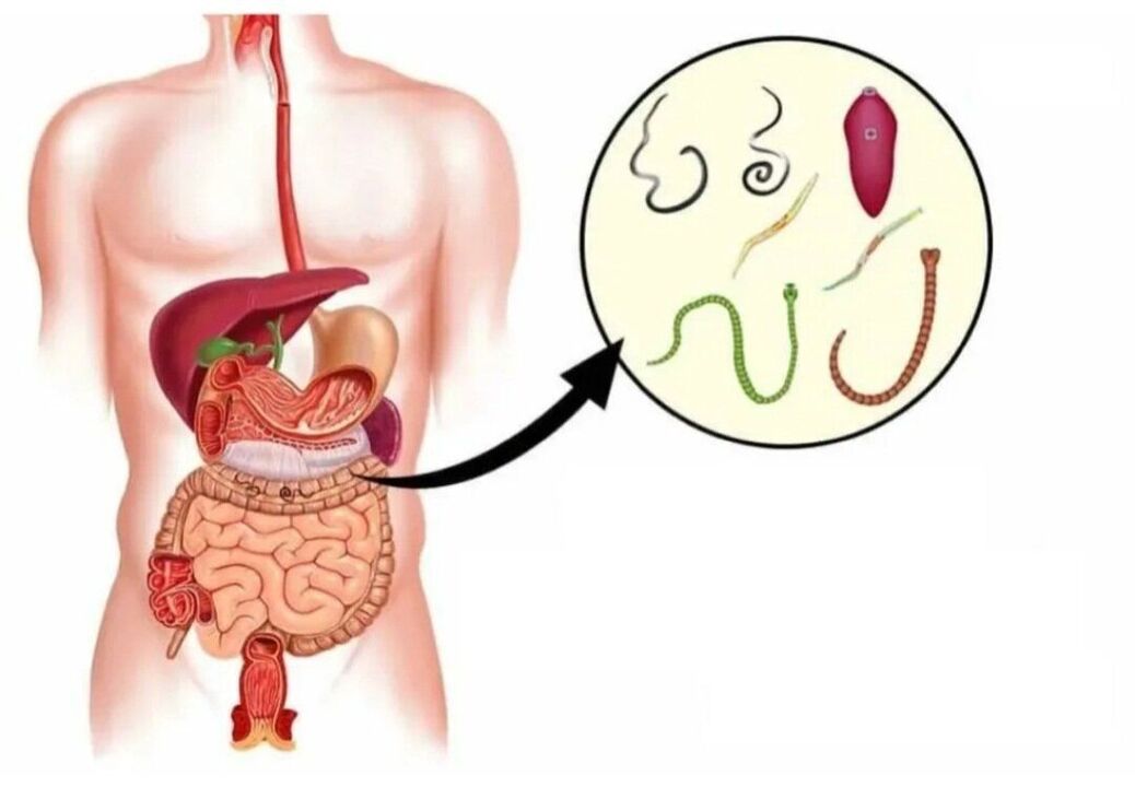 الطفيليات في أعضاء مختلفة