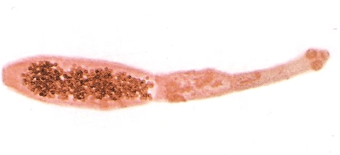 echinococcus