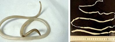 أنواع الطفيليات في جسم الإنسان